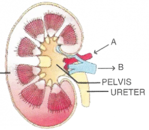 Que-1: Given below is a simple diagram of the longitudinal section of a human kidney. Study the same and answer the following questions: