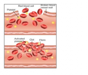 clotting or coagulation occurs in a series of the following steps