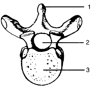 The figure given below shows a kind of vertebra. Study the figure and answer the following questions:
