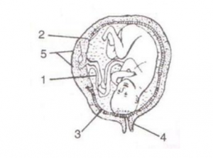 a developing human foetus in the womb