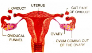 Que-5: Sterilisation in men means preventing the flow of sperms into the seminal vesicles by cutting and ligating the vas deferens. Can there be a corresponding operation made in women? If yes, where?
